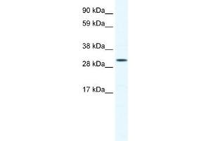 Human Jurkat; WB Suggested Anti-SOX12 Antibody Titration: 0.