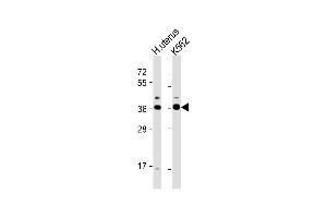 Western Blot at 1:1000 dilution Lane 1: human uterus lysate Lane 2: K562 whole cell lysate Lysates/proteins at 20 ug per lane.