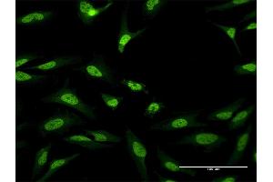 Immunofluorescence of purified MaxPab antibody to CUGBP1 on HeLa cell. (CELF1 antibody  (AA 1-483))