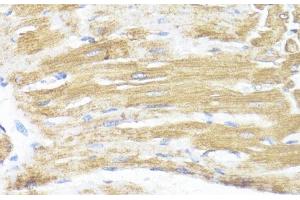 Immunohistochemistry of paraffin-embedded Rat heart using ASMT Polyclonal Antibody at dilution of 1:100 (40x lens). (ASMT antibody)