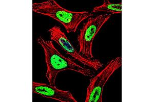 Fluorescent confocal image of Hela cell stained with EWSR1 Antibody .