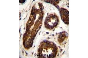 Immunohistochemistry (Paraffin-embedded Sections) (IHC (p)) image for anti-serpin Peptidase Inhibitor, Clade B (Ovalbumin), Member 5 (SERPINB5) (AA 94-123) antibody (ABIN656020)