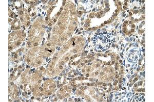TBX15 antibody was used for immunohistochemistry at a concentration of 4-8 ug/ml.