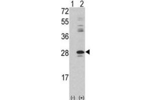 Western Blotting (WB) image for anti-Protein Kinase C, delta Binding Protein (PRKCDBP) antibody (ABIN3003490)