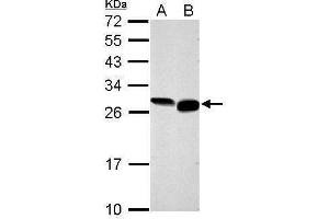 WB Image Sample (30 ug of whole cell lysate) A: NIH-3T3 B: BCL-1 12% SDS PAGE antibody diluted at 1:1000 (GRB2 antibody  (C-Term))