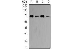 Western blot analysis of CBS expression in Hela (A), MCF7 (B), Romas (C), mouse brain (D) whole cell lysates. (CBS antibody)