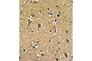 Immunohistochemistry (IHC) image for anti-Calcium Channel, Voltage-Dependent, gamma Subunit 5 (CACNG5) antibody (ABIN3002719) (CACNG5 antibody)