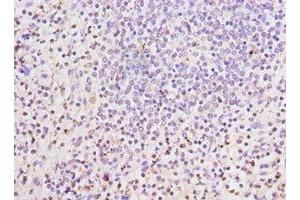 Immunohistochemistry of paraffin-embedded human spleen tissue using ABIN7158655 at dilution of 1:100 (LSP1 antibody  (AA 1-339))