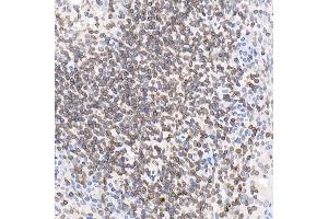 Immunohistochemistry (IHC) image for anti-Thymopoietin (TMPO) (AA 1-410) antibody (ABIN3016207)