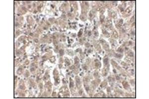 Immunohistochemistry of LDL-R in human liver tissue with this product at 2. (LDLR antibody  (Center))