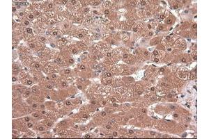 Image no. 4 for anti-Myc Proto-Oncogene protein (MYC) antibody (ABIN1497012) (c-MYC antibody)