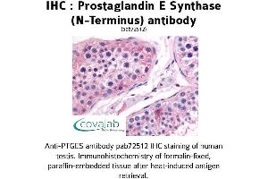 Image no. 1 for anti-Prostaglandin E Synthase (PTGES) (N-Term) antibody (ABIN1738425) (Prostaglandin E Synthase antibody  (N-Term))