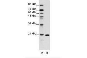 Image no. 1 for anti-Ribosomal Protein L9 (RPL9) (C-Term) antibody (ABIN203024) (RPL9 antibody  (C-Term))