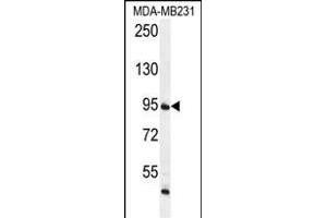 FTSJ3 Antibody (Center) (ABIN655995 and ABIN2845377) western blot analysis in MDA-M cell line lysates (35 μg/lane).