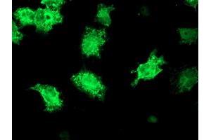 Anti-KATNB1 mouse monoclonal antibody (ABIN2455204) immunofluorescent staining of COS7 cells transiently transfected by pCMV6-ENTRY KATNB1 (RC201852). (KATNB1 antibody)