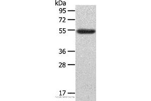 Western blot analysis of Human ovarian cancer tissue, using LAG3 Polyclonal Antibody at dilution of 1:148 (LAG3 antibody)