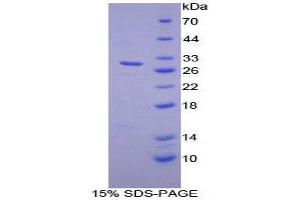 SDS-PAGE (SDS) image for Diacylglycerol Kinase, zeta (DGKZ) (AA 695-932) protein (His tag) (ABIN2124629) (DGKZ Protein (AA 695-932) (His tag))
