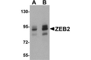 Western blot analysis of ZEB2 in Jurkat cell lysate with ZEB2 antibody at (A) 1 and (B) 2 μg/ml. (ZEB2 antibody  (C-Term))