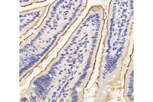 Immunohistochemistry analysis of paraffin-embedded mouse small intestine using ASAH2 (ABIN7074749) at dilution of 1:4200 (ASAH2 antibody)