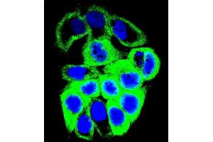 Confocal immunofluorescent analysis of GALNS Antibody (Center) (ABIN655593 and ABIN2845079) with MCF-7 cell followed by Alexa Fluor 488-conjugated goat anti-rabbit lgG (green). (GALNS antibody  (AA 236-263))