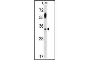 Western blot analysis using ATG5 Antibody  in UM cell line lysates (35ug/lane). (ATG5 antibody)