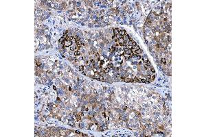 IHC analysis of Rab4/RAB4A using anti-Rab4/RAB4A antibody (ABIN7599733). (Rab4 antibody  (AA 110-216))