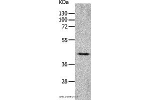Western blot analysis of Mouse heart tissue, using CHRFAM7A Polyclonal Antibody at dilution of 1:700 (CHRNA7 antibody)