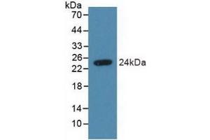 Detection of Recombinant SDC4, Human using Polyclonal Antibody to Syndecan 4 (SDC4) (SDC4 antibody  (AA 18-145))