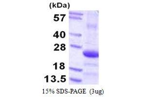 SDS-PAGE (SDS) image for COP9 Signalosome Subunit 8 (COPS8) (AA 1-209) protein (His tag) (ABIN667600) (COPS8 Protein (AA 1-209) (His tag))