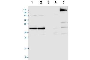 Western blot analysis of Lane 1: RT-4, Lane 2: U-251 MG, Lane 3: Human Plasma, Lane 4: Liver, Lane 5: Tonsil with CCDC94 polyclonal antibody  at 1:100-1:250 dilution. (CCDC94 antibody)