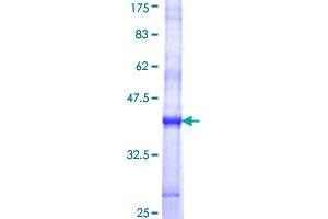 STT3A Protein (AA 603-701) (GST tag)