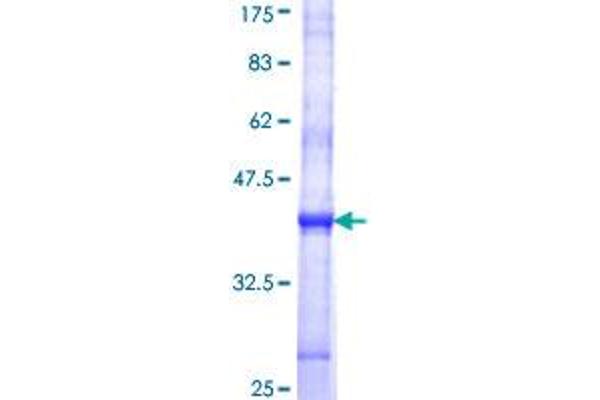 STT3A Protein (AA 603-701) (GST tag)