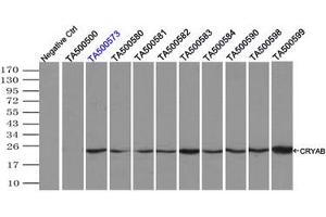 Image no. 2 for anti-Crystallin, alpha B (CRYAB) antibody (ABIN1497645) (CRYAB antibody)