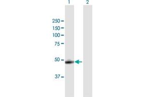 Western Blot analysis of CTSA expression in transfected 293T cell line by CTSA MaxPab polyclonal antibody. (CTSA antibody  (AA 1-480))