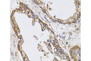 Immunohistochemistry of paraffin-embedded Human prostate using CAST Polyclonal Antibody at dilution of 1:100 (40x lens). (Calpastatin antibody)