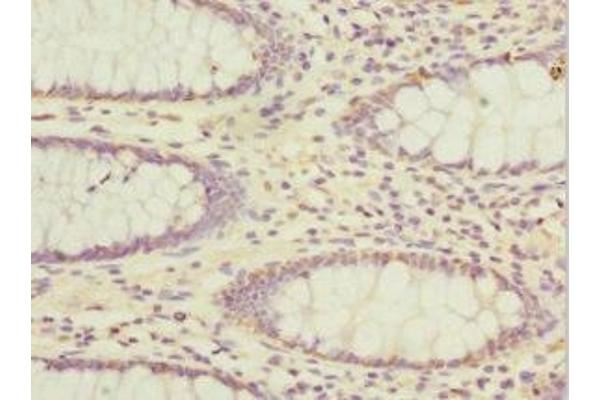 ADAD1 antibody  (AA 1-280)
