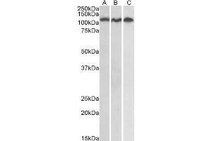 ABIN184721 staining (0. (ADAM17 antibody  (C-Term))