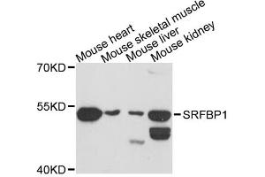 Western blot analysis of extracts of various cell lines, using SRFBP1 antibody.