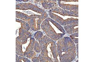 IHC analysis of TTLL2 using anti-TTLL2 antibody (ABIN7600850). (TTLL2 antibody  (AA 24-582))