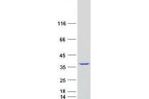 Validation with Western Blot (SNRPA1 Protein (Myc-DYKDDDDK Tag))