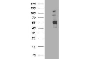 HEK293T cells were transfected with the pCMV6-ENTRY control (Left lane) or pCMV6-ENTRY ALDH3A2 (Right lane) cDNA for 48 hrs and lysed. (ALDH3A2 antibody)