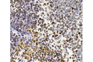 Immunohistochemistry of paraffin-embedded Rat spleen using HIRIP3 Polyclonal Antibody at dilution of 1:100 (40x lens). (HIRIP3 antibody)