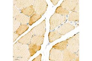Immunohistochemistry of paraffin embedded rat skeletal muscle using ATP2A2 (ABIN7075545) at dilution of 1: 500 (400x lens) (SERCA2 ATPase antibody)