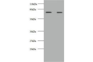 Western blot All lanes: KNG1 antibody at 2 μg/mL Lane 1: HepG2 whole cell lysate Lane 2: 293T whole cell lysate Secondary Goat polyclonal to rabbit IgG at 1/10000 dilution Predicted band size: 72, 48, 44 kDa Observed band size: 72 kDa (KNG1 antibody  (AA 390-644))