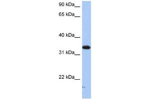 SULT6B1 antibody  (C-Term)