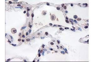 Immunohistochemical staining of paraffin-embedded lung using anti-PECAM1 (TA000121) mouse monoclonal antibody. (CD31 antibody  (AA 425-591))