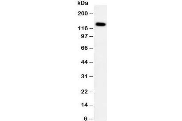 Patched 2 antibody  (C-Term)