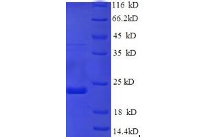 SDS-PAGE (SDS) image for Sex Determining Region Y (SRY) (AA 1-144), (partial) protein (His tag) (ABIN5710418) (SRY Protein (AA 1-144, partial) (His tag))