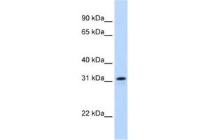 Western Blotting (WB) image for anti-MKI67 FHA Domain-Interacting Nucleolar Phosphoprotein (MKI67IP) antibody (ABIN2462317) (NIFK antibody)