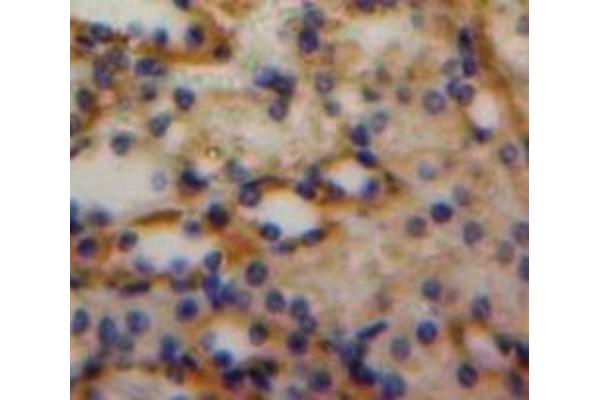 Luteinizing Hormone antibody  (AA 25-120)